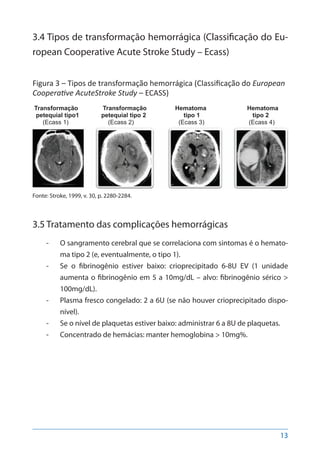 13
3.4 Tipos de transformação hemorrágica (Classificação do Eu-
ropean Cooperative Acute Stroke Study – Ecass)
Figura 3 – Tipos de transformação hemorrágica (Classificação do European
Cooperative AcuteStroke Study – ECASS)
Transformação 	 Transformação	 Hematoma	 Hematoma
petequial tipo1 	 petequial tipo 2	 tipo 1		 tipo 2
(Ecass 1)			 (Ecass 2)		 (Ecass 3)	 (Ecass 4)
Fonte: Stroke, 1999, v. 30, p. 2280-2284.
3.5 Tratamento das complicações hemorrágicas	
-- O sangramento cerebral que se correlaciona com sintomas é o hemato-
ma tipo 2 (e, eventualmente, o tipo 1).
-- Se o fibrinogênio estiver baixo: crioprecipitado 6-8U EV (1 unidade
aumenta o fibrinogênio em 5 a 10mg/dL – alvo: fibrinogênio sérico >
100mg/dL).
-- Plasma fresco congelado: 2 a 6U (se não houver crioprecipitado dispo-
nível).
-- Se o nível de plaquetas estiver baixo: administrar 6 a 8U de plaquetas.
-- Concentrado de hemácias: manter hemoglobina > 10mg%.
 
