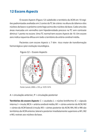 41
12 Escore Aspects
O escore Aspects (Figura 12) subdivide o território da ACM em 10 regi-
ões padronizadas avaliadas em 2 cortes daTC de crânio: na altura do tálamo e dos
núcleos da base e o próximo corte logo acima dos núcleos da base. Cada uma das
áreas marcadas em vermelho com hipodensidade precoce na TC sem contraste
diminui 1 ponto no escore. Uma TC normal tem escore Aspects de 10. Um escore
zero indica isquemia difusa em todo o território da artéria cerebral média.
Pacientes com escore Aspects ≤ 7 têm risco maior de transformação
hemorrágica e pior evolução neurológica.
Figura 12 – Escore Aspects
Fonte: Lancet, 2000, v. 355, p. 1670-1674.
A = circulação anterior; P = circulação posterior
Territórios do escore Aspects: C = caudado; L = núcleo lentiforme; IC = cápsula
interna; I = insula; MCA = artéria cerebral média; M1 = córtex anterior da ACM; M2
= córtex da ACM lateral à insula; M3 = córtex posterior da ACM; M4, M5 e M6 são
territórios da ACM anterior, lateral e posterior imediatamente superiores a M1, M2
e M3, rostrais aos núcleos da base.
 