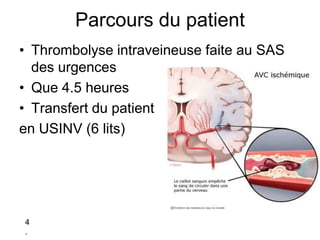 Parcours du patient
• Thrombolyse intraveineuse faite au SAS
des urgences
• Que 4.5 heures
• Transfert du patient
en USINV (6 lits)
4
.
 