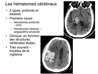 Les hématomes cérébraux
• 2 types: profonds et
lobaires
• Première cause
– hématomes profonds
– HTA
– Hématomes lobaires –
angiopathie amyloïde
• Clinique- en fonction
des structures
cérébrales lésées
• Très souvent –
troubles de la
vigilance
 