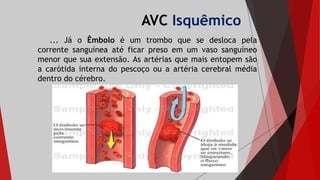AVC Isquêmico
... Já o Êmbolo é um trombo que se desloca pela
corrente sanguínea até ficar preso em um vaso sanguíneo
menor que sua extensão. As artérias que mais entopem são
a carótida interna do pescoço ou a artéria cerebral média
dentro do cérebro.
 