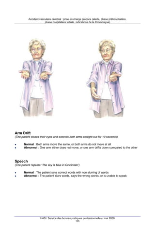 Accident vasculaire cérébral : prise en charge précoce (alerte, phase préhospitalière,
phase hospitalière initiale, indications de la thrombolyse)

Arm Drift
(The patient closes their eyes and extends both arms straight out for 10 seconds)
Normal : Both arms move the same, or both arms do not move at all
Abnormal : One arm either does not move, or one arm drifts down compared to the other

Speech
(The patient repeats “The sky is blue in Cincinnati”)
Normal : The patient says correct words with non slurring of words
Abnormal : The patient slurs words, says the wrong words, or is unable to speak

HAS / Service des bonnes pratiques professionnelles / mai 2009
135

 