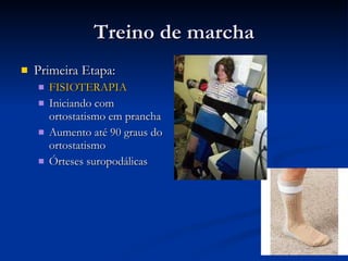 Treino de marcha Primeira Etapa: FISIOTERAPIA Iniciando com ortostatismo em prancha Aumento até 90 graus do ortostatismo Órteses suropodálicas 
