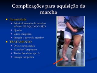 Complicações para aquisição da marcha Espasticidade Principal alteração de membro inferior: PÉ EQUINO-VARO Quedas Gasto energético Impedir o apoio do membro TRATAMENTO Órtese suropodálica Exercício Terapêutico Toxina Botulínica tipo A Cirurgia ortopédica 