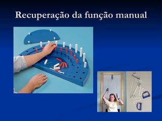 Recuperação da função manual 
