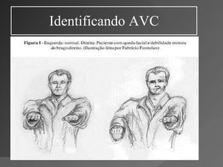 Identificando AVC 