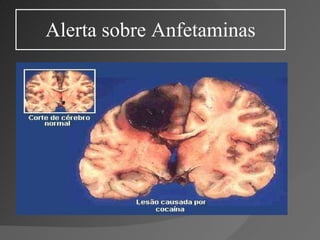 Alerta sobre Anfetaminas 