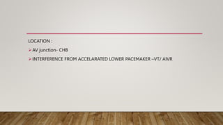 LOCATION :
AV junction- CHB
INTERFERENCE FROM ACCELARATED LOWER PACEMAKER –VT/ AIVR
 