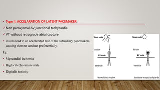 • Type II: ACCELARATION OF LATENT PACEMAKER:
Non paroxysmal AV junctional tachycardia
VT without retrograde atrial capture
• insults lead to an accelerated rate of the subsidiary pacemakers,
causing them to conduct preferentially.
Eg:
• Myocardial ischemia
• High catecholamine state
• Digitalis toxicity
 