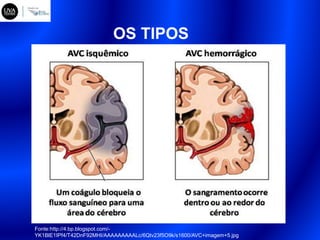 OS TIPOS
Fonte:http://4.bp.blogspot.com/-
YK1BlE1IPf4/T42DnF92MHI/AAAAAAAAALc/6Qtv23f5O9k/s1600/AVC+imagem+5.jpg
 