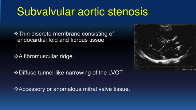 Echo assesment of Aortic Stenosis and Regurgitation