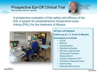 Prospective Epi-Off Clinical Trial
Ruhr University, Bochum, Germany
A prospective evaluation of the safety and efficacy of the
KXL II system for photorefractive intrastromal cross-
linking (PiXL) for the treatment of Myopia
40 Eyes with Myopia
Follow-up at 1, 3, 6 and 12 Months
Evaluations to include:
• UCVA
• BSCVA
• Autorefraction
• Manifest refraction
• Slit lamp examination
• Intraocular Pressure
Measurement
• Anterior Segment OCT
• Pentacam measurements
• Aberrometry
• Specular Microscopy
Professor H. Burkhard Dick
Matthias Elling, MD
Ruhr University
Bochum, Germany
MA-00569A
 