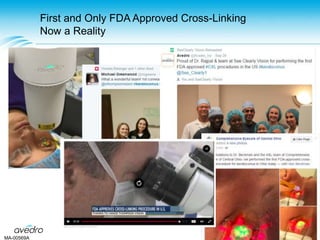 First and Only FDA Approved Cross-Linking
Now a Reality
MA-00569A
 