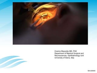 Cosimo Mazzotta MD, PhD
Department of Medical Surgical and
Neurosciences, Ophthalmology Unit
University of Siena, Italy
MA-00569A
 