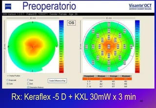Beam Profiles for KXL and UV-X Light SourcesPredictability+5mm Out of PlaneAt Focus-5mm Out of PlaneAvedro KXLUV-XMA-00057, Rev. A