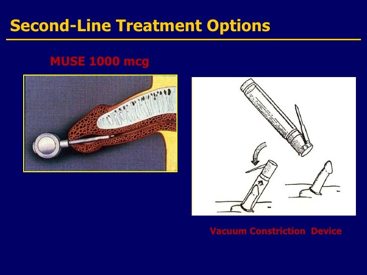 Image Gallery Muse 1000 Mg Image Gallery Muse 1000 Mg