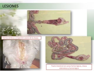 LESIONESEdema de cabeza y cuello, tráquea hemorrágicaEn aves de postura se observan óvulos flácidos y degenerados, hemorragias y palidez de otros órganos reproductores, así como yemas de huevos en la cavidad abdominal.La presencia de lesiones hemorrágicas en el tracto gastrointestinal, estas lesiones  son frecuentes enproventrículo, ciego, cloaca, tonsilas cecales, tracto intestinal y necrosis en la pared intestinal.
