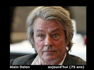 Alain Delon  aujourd’hui (75 ans) 