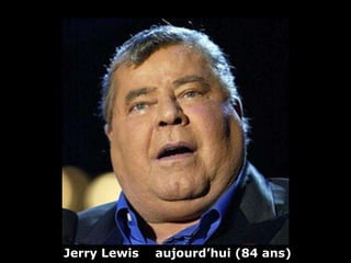 Jerry Lewis   aujourd’hui   (84 ans) 