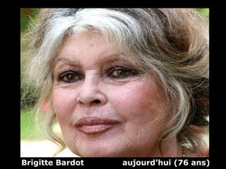 Brigitte Bardot  aujourd’hui (76 ans) 