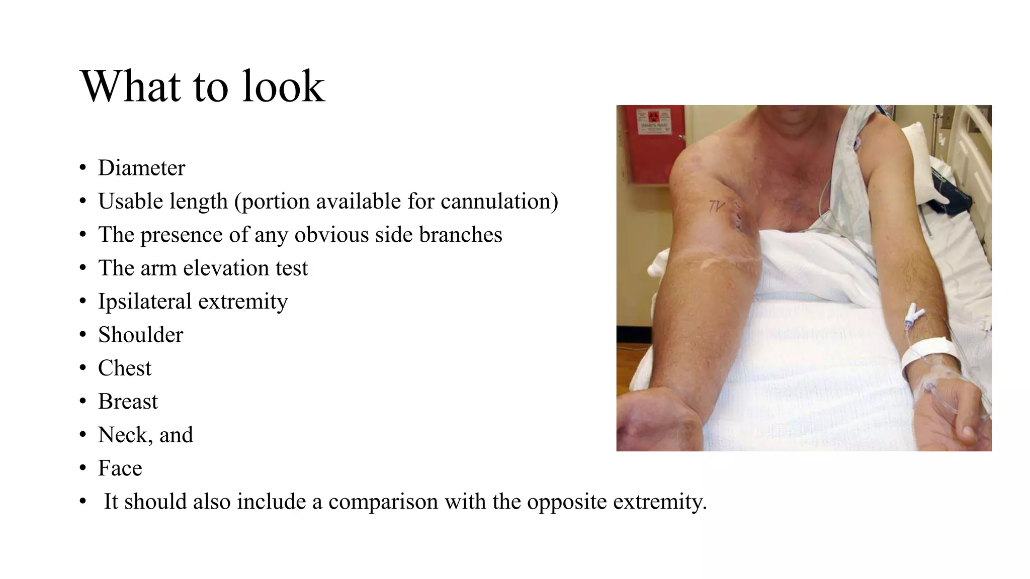 What to look
• Diameter
• Usable length (portion available for cannulation)
• The presence of any obvious side branches
• The arm elevation test
• Ipsilateral extremity
• Shoulder
• Chest
• Breast
• Neck, and
• Face
• It should also include a comparison with the opposite extremity.
 