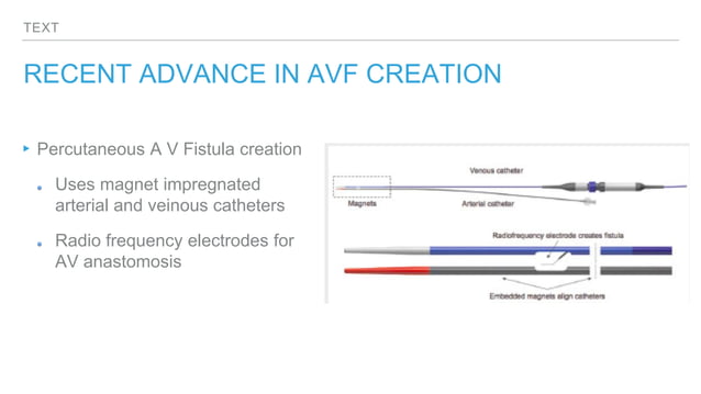 A V FISTULA .pptx