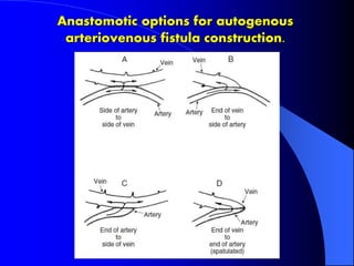 Long term Hemodialysis Vascular Access (AVFs and AVGs) | PPTX