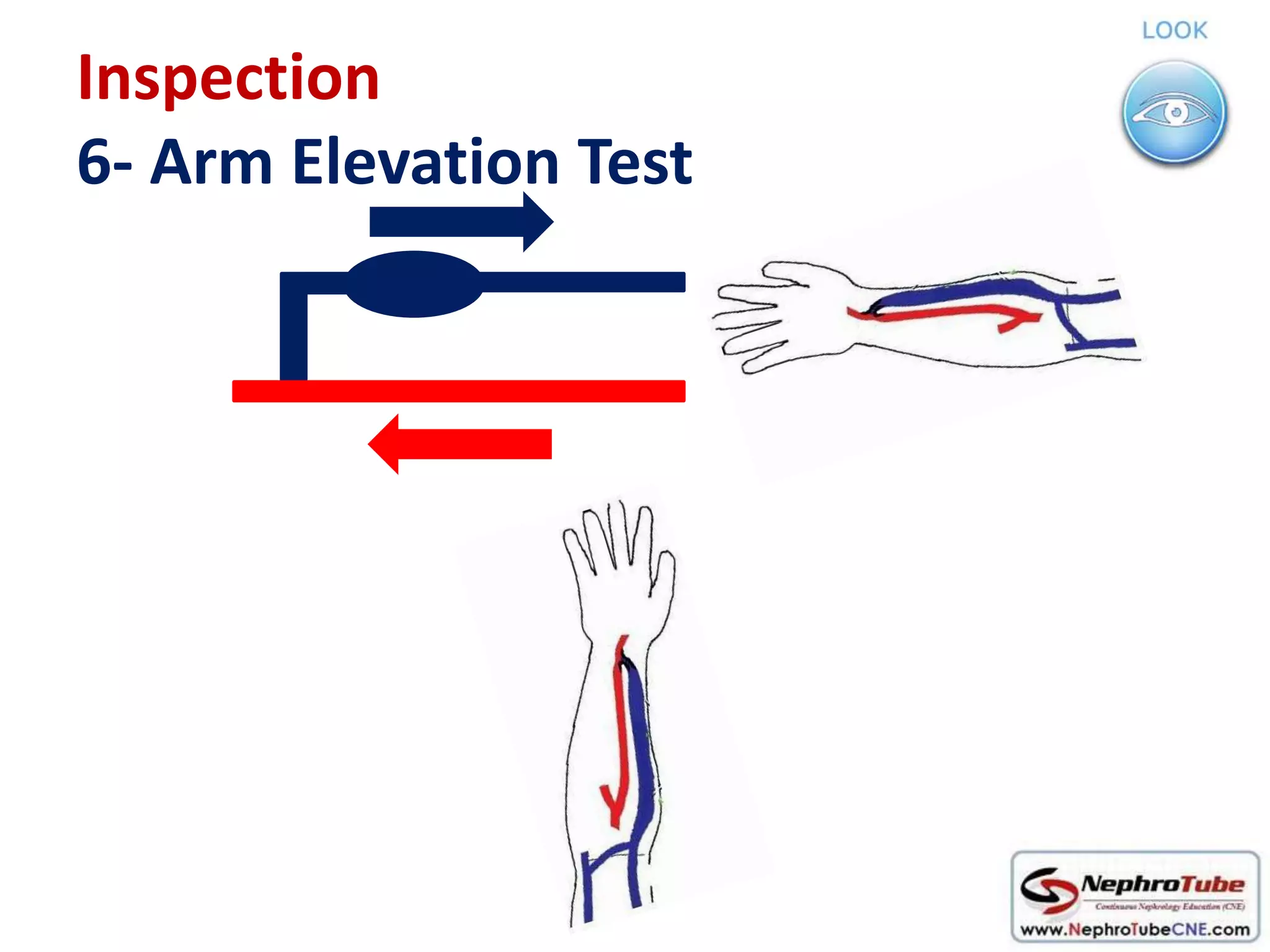How to examine AVF in 10 minutes - Dr. Gawad | PPTX
