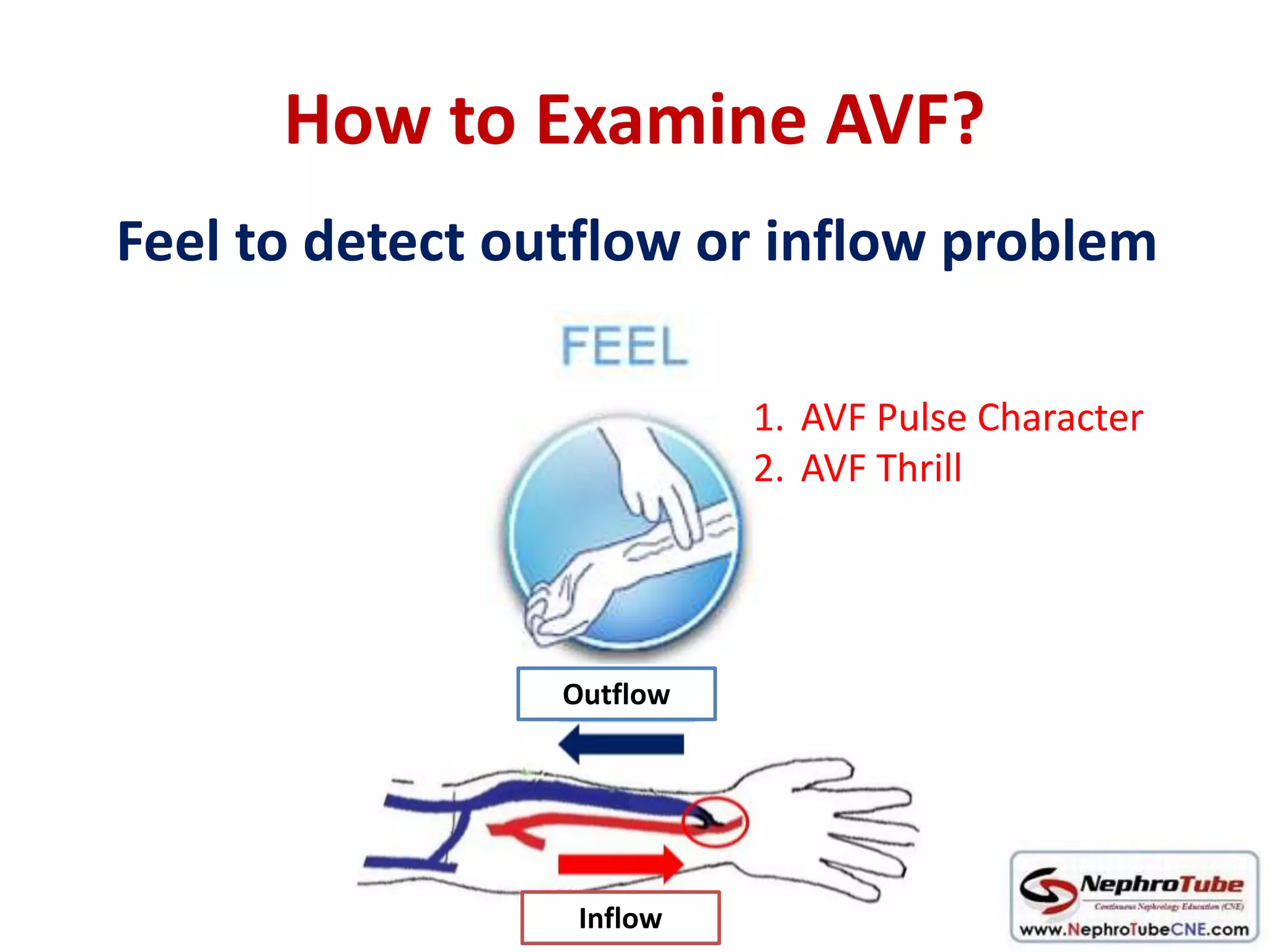 How to examine AVF in 10 minutes - Dr. Gawad | PPTX