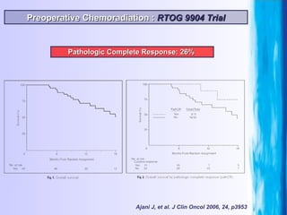 Preoperative Chemoradiation :  RTOG 9904 Trial Ajani J, et al. J Clin Oncol 2006, 24, p3953 Pathologic Complete Response: 26%  