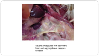 Severe airsacculitis with abundant
foam and aggregates of caseous
exudate.
 