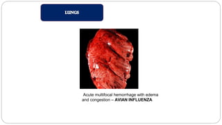 Acute multifocal hemorrhage with edema
and congestion – AVIAN INFLUENZA
 