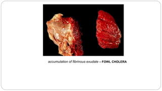 accumulation of fibrinous exudate – FOWL CHOLERA
 