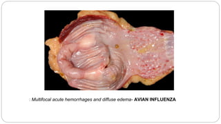 : Multifocal acute hemorrhages and diffuse edema- AVIAN INFLUENZA
 