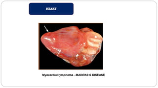 Myocardial lymphoma –MAREKS’S DISEASE
 