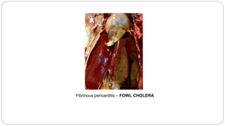 Fibrinous pericarditis – FOWL CHOLERA
 
