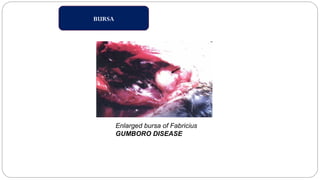 BURSA
Enlarged bursa of Fabricius
GUMBORO DISEASE
 