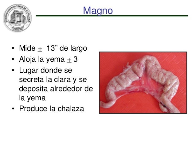 El encaje sheynogo del departamento de la columna vertebral