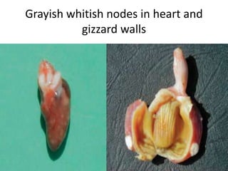 Grayish whitish nodes in heart and
gizzard walls
 
