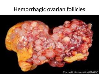 Hemorrhagic ovarian follicles
 