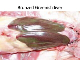 Bronzed Greenish liver
 