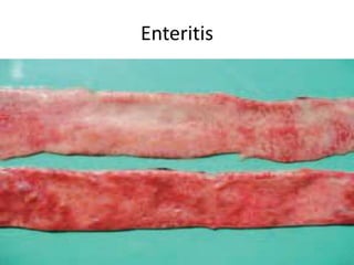 Enteritis
 