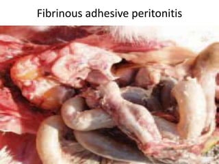 Fibrinous adhesive peritonitis
 
