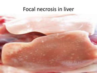 Focal necrosis in liver
 