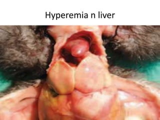 Hyperemia n liver
 