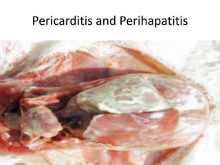 Pericarditis and Perihapatitis
 