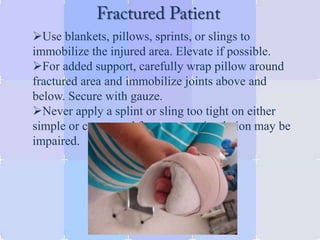 Use blankets, pillows, sprints, or slings to
immobilize the injured area. Elevate if possible.
For added support, carefully wrap pillow around
fractured area and immobilize joints above and
below. Secure with gauze.
Never apply a splint or sling too tight on either
simple or compound fractures as circulation may be
impaired.
 