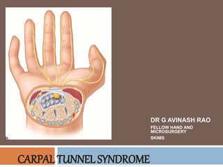 CARPAL TUNNEL SYNDROME
DR G AVINASH RAO
FELLOW HAND AND
MICROSURGERY
SKIMS
 