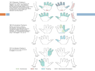 carpal tunnel syndrome - hand surgery | PPT