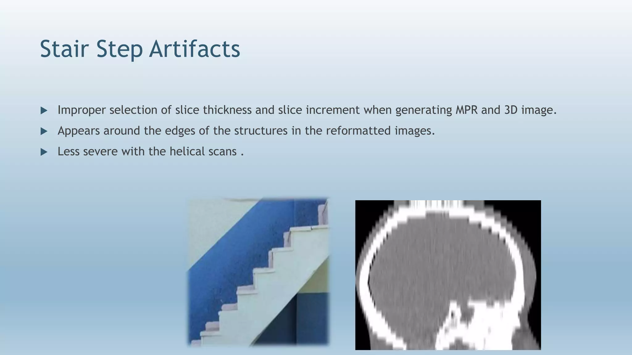Stair Step Artifacts
 Improper selection of slice thickness and slice increment when generating MPR and 3D image.
 Appears around the edges of the structures in the reformatted images.
 Less severe with the helical scans .
 